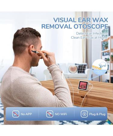 ScopeAround Otoscope with 2.8-Inch HD IPS Screen - 3.9mm HD Otoscope with Light for Clear Ear Inspections | International Shipping Available - Buy Online on GoSupps.com