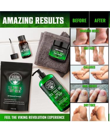 Tea Tree Foot Soak Kit - Extra Strength Treatment for Foot Fungus, Athlete's Foot, and Dry Cracked Feet - Buy Online on GoSupps.com