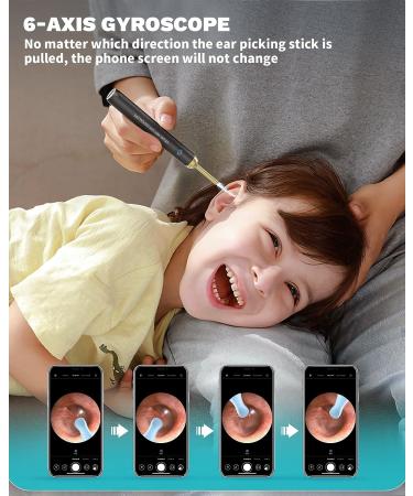 KAUGIC Ear Wax Removal Tool Camera - Premium 1080P HD Otoscope with 8 Pcs Ear Picker Set - Waterproof Earwax Remover for iPhone & Android - Ear Cleaner with Camera - Buy Online on GoSupps.com