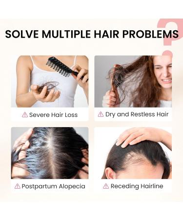 NiceTop Hair Growth Supplement, Hair Care Support for Strength, Thickness Growth, with Biotin Vitamin A, C, E, Zinc, 60 Capsules - Buy Online on GoSupps.com