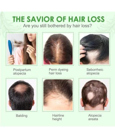 Rosemary Hair Oil for Hair Growth and Skin Care Hair Strengthening Oil for Fuller Healthier Hair Anti Hair Loss and Nourishes Scalp for Hair Growth Repair | 60 ml - Buy Online on GoSupps.com