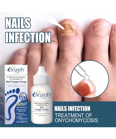 High Strength Nail Fungal Treatment by The Beauty Centre | 80% Formula for Toe and Finger Nails | Includes Free Nail File and Brush | 30ml - Buy Online on GoSupps.com
