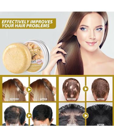 Ginger Hair Regrowth Shampoo Bar - Natural Organic Formula for Hair Growth (2 Pcs) - Buy Online on GoSupps.com