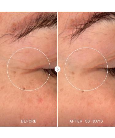 Pai Skincare - Age Confidence Renewal Serum with NAD+ and TriPeptide | Natural Vegan Sensitive Skincare (1 fl oz | 30 ml) - Buy Online on GoSupps.com