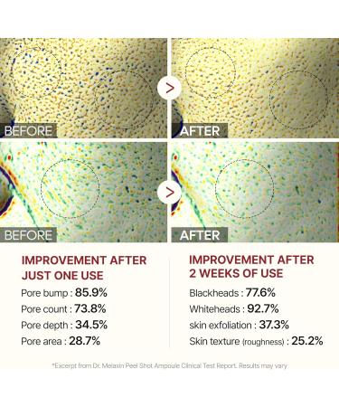 Dr.Melaxin Ampoule Gommage claircissant au Riz Blanc limination des Cellules Mortes de la Peau Exfoliant Doux pour Visage et Corps Pour Tous les Types de Peau Soin de la Peau Cor en 80ml - Buy Online on GoSupps.com