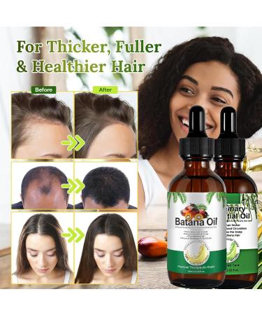 Batana Oil for Hair Growth Hair Care Set with Rosemary Hair Oil & Natural Batana Oil Pure Batana Oil for Healthier Thicker Fuller Hair Prevents Hair Loss & Increases Shine - Buy Online on GoSupps.com