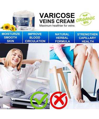 Varicose Veins Cream - Natural Treatment for Legs, Improve Blood Circulation, Strengthen Capillaries & Relieve Tired Legs - Buy Online on GoSupps.com