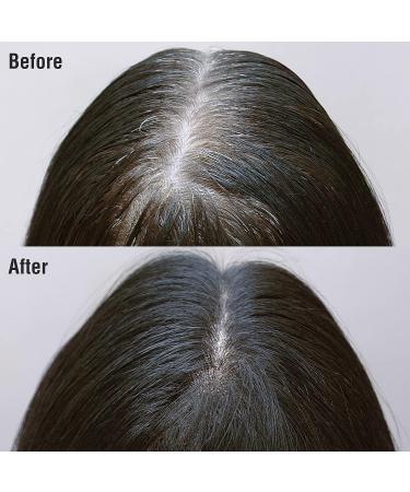 Kiss Root Cover Up Gray Concealer Spray Tintation Temporary Hair Color Spray Root Touch Up Spray Hair Dye 2.82 oz. 2 PACK (Dark Brown) 2 Pack-Darkest Brown - Buy Online on GoSupps.com