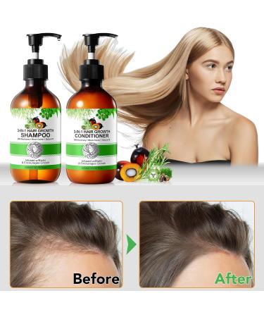 3 in 1 Shampoo and Conditioner with Biotin Rosemary Oil Black Castor Oil and Batana 2 x 10.56 fl oz Shampoos and Conditioners to Strengthen and Restore Brittle Hair (#3) - Buy Online on GoSupps.com