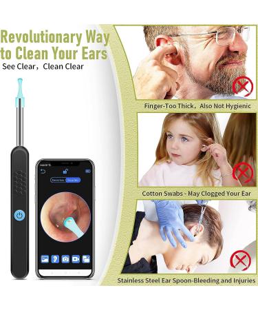 Smart Wireless Ear Wax Removal Tool Camera | Visual Ear Cleaner Kit for Babies, Kids, Adults, Pets | 1296P Ear Otoscope Scope with Cleaning Tool - Buy Online on GoSupps.com