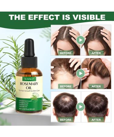 Buy YLNALO Rosemary Hair Growth Serum - Nourishes Scalp & Damaged Hair Stimulates Growth for All Hair Types (2.02 fl oz) - International Shipping Available - Buy Online on GoSupps.com