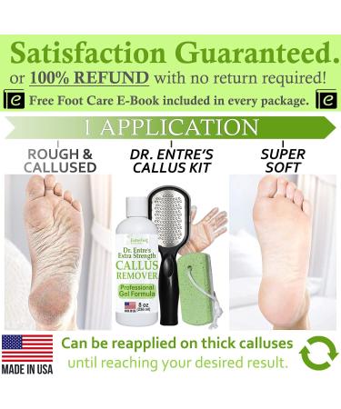 Dr. Entre Callus Remover Kit for Feet - 8oz Gel, Foot File, Pumice Stone, 5 Glove Pairs, Spa Pedicure Tools - Buy Online on GoSupps.com