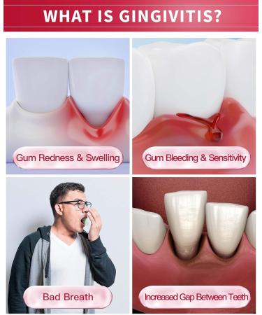 CAREDO Gingivitis Toothpaste Gum Repair for Bleeding Gums Swollen Gums Treatment for Gum Sensitivity Gingivitis Treatment for Gum Disease Reverse Gingivitis Treatment for Adults Oral Care 3.52OZ - Buy Online on GoSupps.com