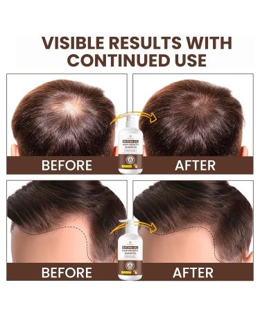 Batana Oil Hair Growth Shampoo - Natural Solution for Thinning Hair | Daily Hair Care for Women & Men - 10.1 fl. oz - Buy Online on GoSupps.com