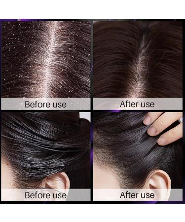  Goowafur Rosemary and onion shampoo - Scented anti-frizz shampoo - 300 ml - Does not damage hair growth - Protective thickening - Smooth hair - Regulates humidity - Moisturizing Goowafur - Buy Online on GoSupps.com