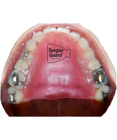 RPE Tongue Guard - Prevents and Heals Tongue Sores from Dental Expanders - Buy Online on GoSupps.com