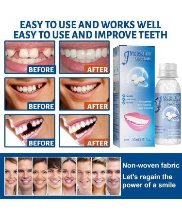 Dental Repair Kit - Temporary Tooth Filling Beads for DIY Fixing Thermal Forming Teeth Repair - False Teeth Moldable Granules - Dental Bridge Repair Solution - Buy Online on GoSupps.com