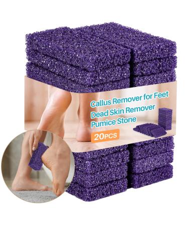 Sukh 20pcs Pumice Stone for Feet - Foot Scrubber Dead Skin Remover Purple Spa Salon Foot Scrubber Sponge Foot Pumice Stone Foot Sanding Sponge for Heavy Callused Feet Foot Care Kit Set for Women Man.