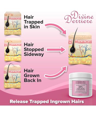 Divine Derriere Ingrown Hair Treatment Pads - Razor Bump Stopper & After Shave Solution for Men and Women - Buy Online on GoSupps.com