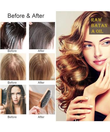 Dr. Sebi Batana Oil - 100% Pure Hair Growth Oil | Unrefined Hair Loss Prevention & Thickness Enhancer for Men & Women | 4.23 OZ - Buy Online on GoSupps.com