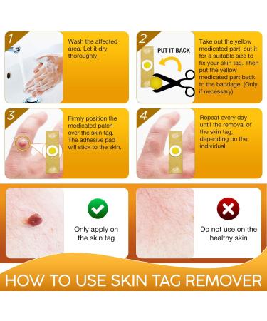 Samsali Skin Tag Remover Pads - 42 Count | Advanced & Effective Skin Tag Removal - Buy Online on GoSupps.com