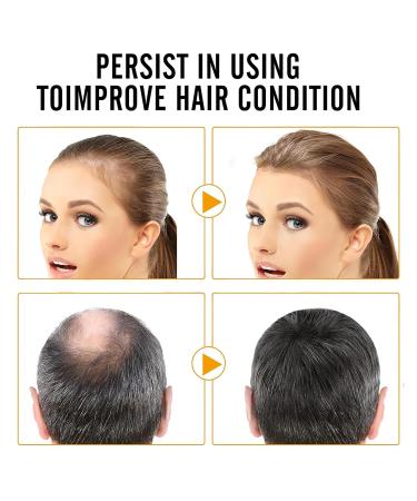 Veganic Organic Hair Repair Oil - Revitalize Thin Dry Damaged Hair with Rosemary Oil (2PCS) - Enhance Hair Health - Buy Online on GoSupps.com