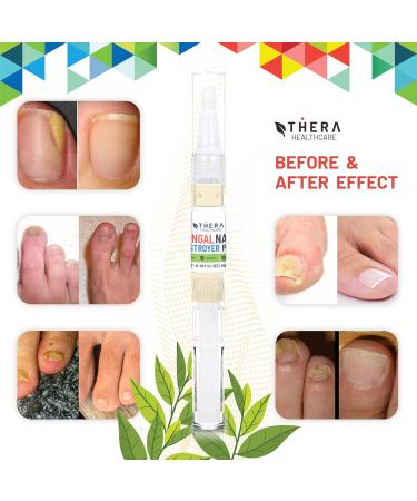 Fungal Nail Destroyer Pens (3 Pack) Natural Anti Fungal Nail Treatment Finger and Toe Nail Fungal Treatment Contains Tea Tree Oil & Vitamin E Nail Repair Treatment with Nail File 3ml/pc - Buy Online on GoSupps.com