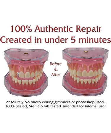 SmileFix Color Matching Deluxe Dental Repair Kit - Fill Gaps and Replace Broken Teeth at Home - Buy Online on GoSupps.com