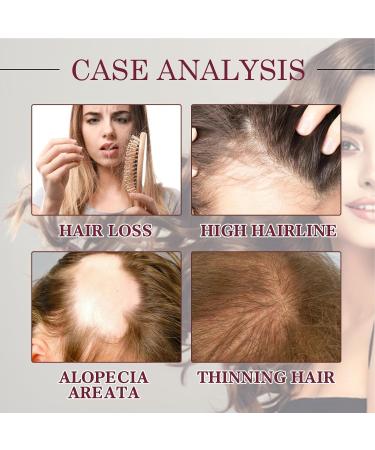 Onion Hair Thickening Spray - 30ml Onion Oil Hair Anti Loss Spray | Red Onion Hair Oil For Hair Regrowth Strengthening Hair Roots And Follicles | Pure Onion Oil Spray For Hair Thickening - Buy Online on GoSupps.com