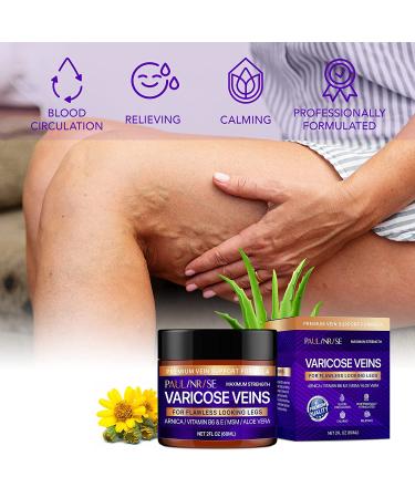 Natural Varicose Veins Cream for Pain Relief - Effective Treatment for Varicose and Spider Veins on Legs - Buy Online on GoSupps.com