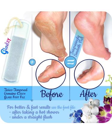 Real Czech Glass Foot Fish - Double-Sided Grit for Gentle Pedicure & Spa Care | EU Quality Corneal Removal Tool for Rough Skin & Heels - Buy Online on GoSupps.com
