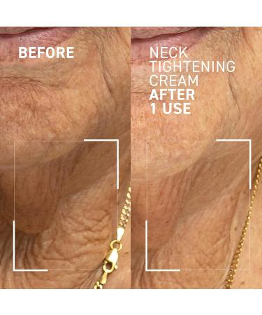 Dr. Brandt Eye Gel & Neck Cream Duo: Say Goodbye to Bags and Sagging Skin - Buy Online on GoSupps.com