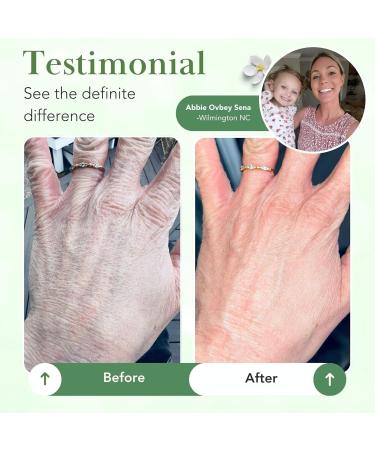 Theraplex Skin Barrier Balm - Moisturizer for Dry Sensitive Skin - Paraben-Free Noncomedogenic Hypoallergenic - 6 Oz - Dermatologist Recommended - Buy Online on GoSupps.com