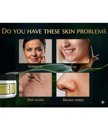  Elite X Advanced Snail 92 - Snail Slime Cream with Hyaluronic Acid - Anti-Acne and Anti-Wrinkle Face Cream - For All Skin Types - Chinese Facial Treatment - Buy Online on GoSupps.com