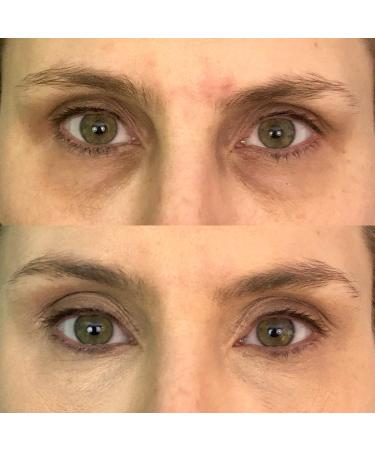 Dermaflage Color Correcting Palette for Dark Circles, Redness, Bruises & Dark Spots | 6.9g/.24oz - Buy Online on GoSupps.com