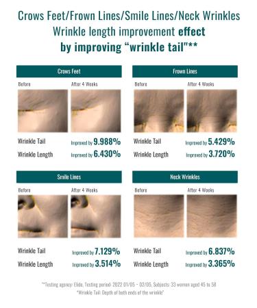 ISA KNOX Age Focus Prime Wrinkle For All (4.9fl oz) - Plant-Based Korean Skin Care Solution for Skin Elasticity & Moisturization by LG Beauty. Daytime Retinol. - Buy Online on GoSupps.com