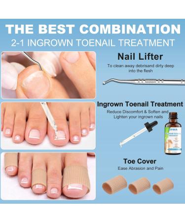 Ingrown Toenail Treatment Kit | Drops Softener & Double-Sided Pedicure Tool for Easy Care | Perfect Solution for Thick Nails & Nail Pain Relief - Buy Online on GoSupps.com