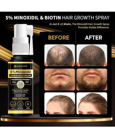 Minoxidil for Women & Men - 5% Beard Growth Spray with Biotin | Extra Strength Hair Regrowth - 2 Fl Oz - Buy Online on GoSupps.com
