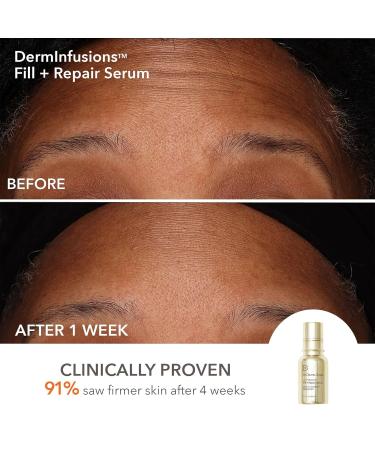 Dr Dennis Gross DermInfusions Discovery Kit: Plump Fill & Repair Skincare Set DermInfusions Discovery Kit (Pack of 3) - Buy Online on GoSupps.com
