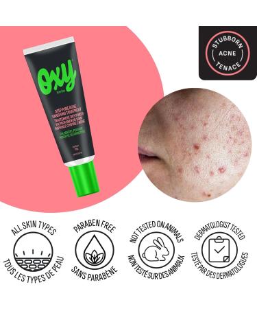 Oxy Acne Vanishing Treatment 0.10-Inches - Buy Online on GoSupps.com