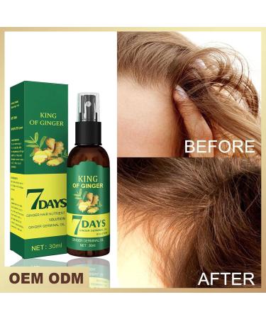  Lecerrot Hair Growth Germinal Oil Nourishing Spray for Hair Growth Anti-Hair Loss Hair Growth Serum 50ml - Buy Online on GoSupps.com