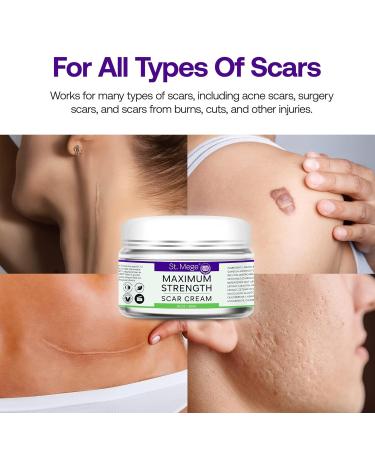 Maximum Strength Stretch Mark Cream | Scar Treatment for Old & New Scars | C-Section Recovery Cream - Buy Online on GoSupps.com
