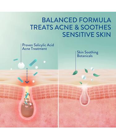 Cetaphil Gentle Clear Mattifying Acne Moisturizer | 0.5% Salicylic Acid | 3oz - Buy Online on GoSupps.com