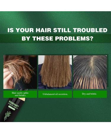 3 pieces rosemary shampoo for hair growth rosemary shampoo against hair loss deep cleansing restorative nourishing moisturizing for women and men - Buy Online on GoSupps.com