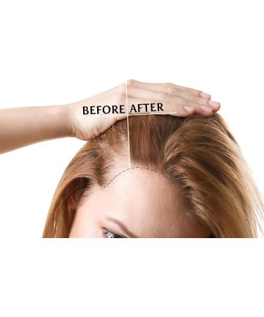 khenz Invigorating Shampoo regenerating stem cells anti-hair loss 250 ml - Buy Online on GoSupps.com