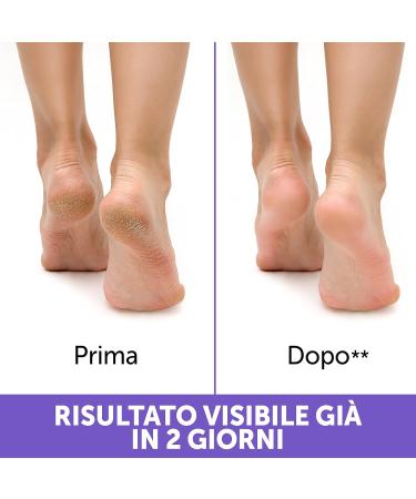 Podovis C/Talloni Screpolati 75 ml - Healing Cream for Cracked Heels | International Shipping Available - Buy Online on GoSupps.com