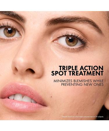 Vichy Normaderm S.O.S Acne Rescue Spot Corrector | Acne Spot Treatment with 10% Sulfur, Niacinamide & Glycolic Acid | Blemish Remover for Sensitive Skin - Buy Online on GoSupps.com