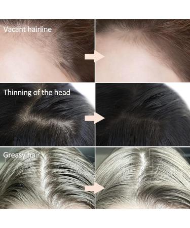 Buy Boobeen Hair Powder for Thin Hair - Instant Hair Loss Cover & Root Touch Up - Dark Brown Hairline Powder for Women & Men - Buy Online on GoSupps.com