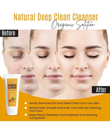 Turmeric Facial Cleanser - Natural Anti-Aging Exfoliating Formula for Acne Scars Age Spots & Sun Damage - 5 OZ Nourishing Glow - Buy Online on GoSupps.com