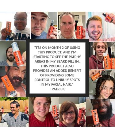 5% Minoxidil with Extra Biotin for Hair Growth - 1 Month Supply - Strongest Minox Cocktail Treatment for Men and Women - 2Fl Oz - Buy Online on GoSupps.com